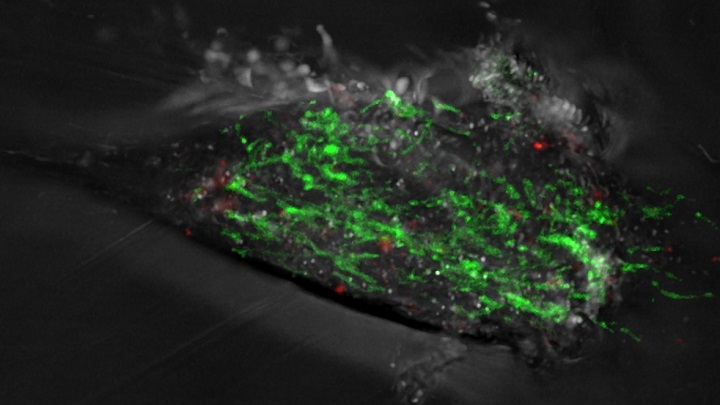 Imatge d’un fibroblast d’un pacient amb malaltia de Parkinson. Els mitocondris, marcats en color verd, i els fragments de mitocondris danyats, en vermell. Alguns d’aquests fragments de mitocondris afectats s’alliberen a l’espai extracel·lular. Crèdit: IIBB-CSIC.