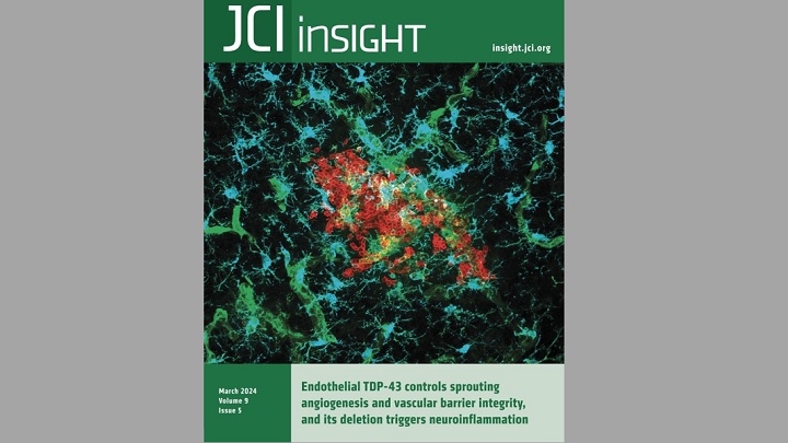 La revista JCI Insight dedica la portada a una investigación de la UB y del IDIBELL que permitirá conocer mejor la relación entre los defectos en la vascularización del sistema nervioso central y la inflamación asociada a algunas enfermedades neurodegenerativas.