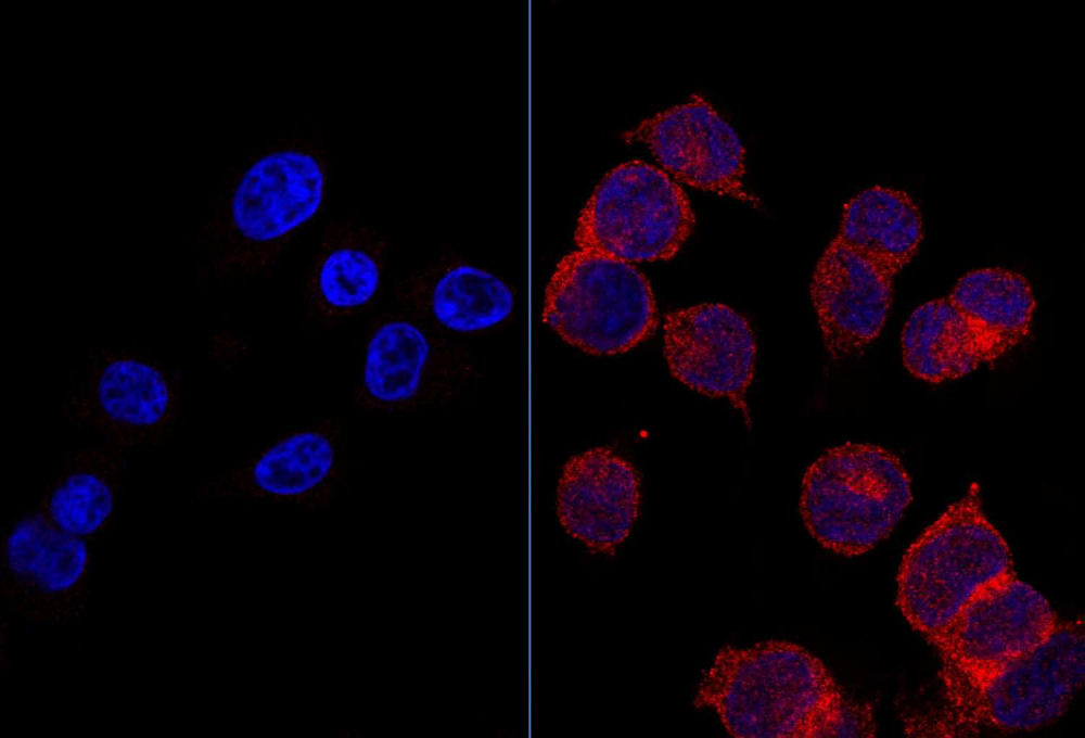 A l'esquerra, cèl·lules sanes amb receptors de glucosa (vermell). A la dreta, cèl·lules tumorals amb receptors de glucosa (vermell).