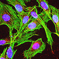 La localització de la proteïna tau (vermell) en les cèl·lules glials.