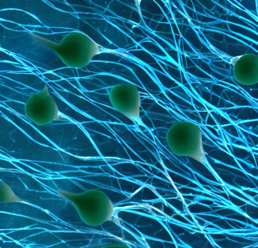 Digital art piece made with the Stable Diffusion algorithm showing neurons expressing Unc5 (in green) over radial glia fibres expressing GPC3 (in blue).