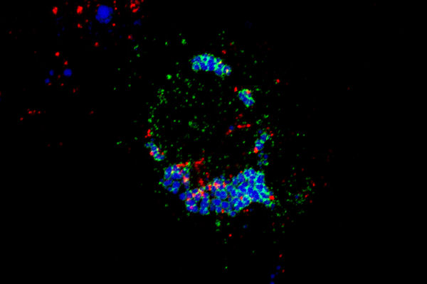 Imatge de microscòpia confocal en què es poden observar la proteïna SNX13 (color verd) en regions del reticle endoplasmàtic que estableixen contactes amb gotes lipídiques (color blau) i lisosomes en què està present el lípid BMP (color vermell). 