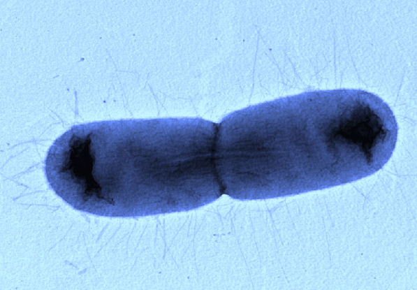 bacteria1.jpg