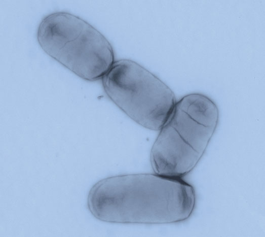 L’estudi de la UB s’ha centrat en el bacteri Salmonella enterica, un patogen entèric que causa des de gastroenteritis lleus fins a infeccions sistèmiques severes en humans.