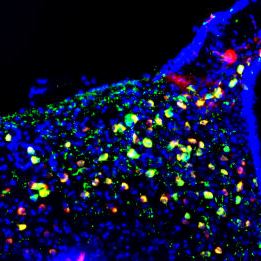 Imatge de microscòpia de fluorescència del nucli arcuat de l'hipotàlem on s'aprecien, en color verd, les neurones POMC. Imatge: Alicia G. Gómez Valadés