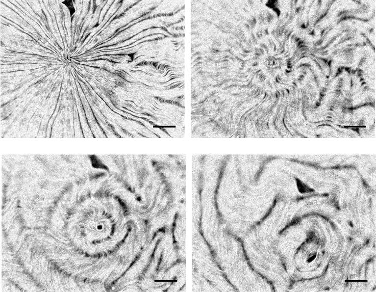 Fluorescence micrographs showing the spontaneous evolution of a radially aligned active nematic towards the turbulent regime.