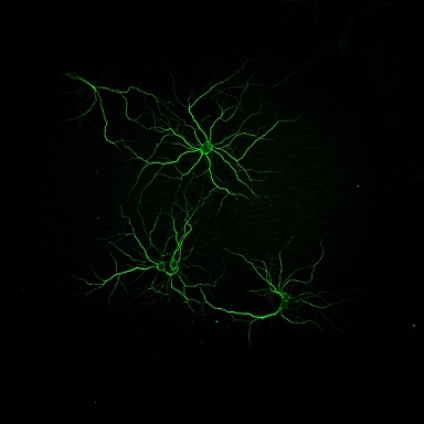 Fotografia representativa de neurones primàries en cultiu marcades amb un anticòs. Foto: Albert Giralt / UB.