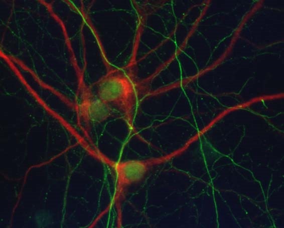 Imatge d'un cultiu primari neuronal amb detecció del marcador de dendrites MAP2 (vermell) i el marcador d'axons Neurofilament (verd).