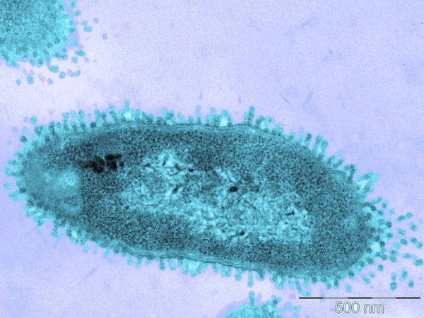 Imatge de microscòpia electrònica d'<i>Escherichia coli</i> tractada amb polymyxina B (s'hi pot veure les petites protuberàncies a la membrana causades per l'antibiòtic).