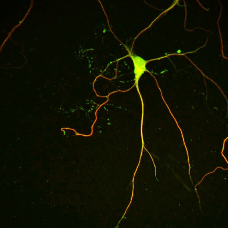 La imatge mostra una neurona cultivada tenyida amb anticossos que etiqueten microtúbuls. NEK7 promou l'estabilitat dels microtúbuls dendrítics, important per al creixement i la ramificació adequada de les dendrites. Imatge: F. Freixo (IRB Barcelona) 