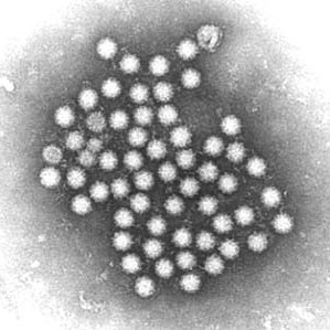 Norovirus.