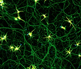 This is the first time that neurons derived from human iPSCs have been matured with a synthetic matrix.