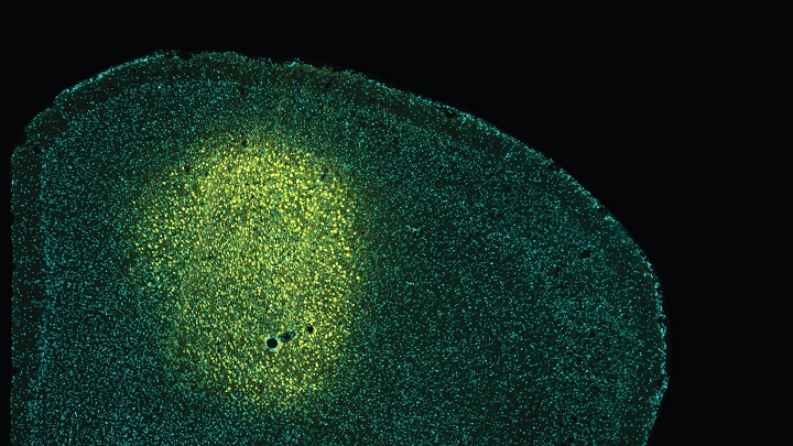 The administration of fluorescent sensors in the M2 cortex (in yellow) has made it possible to understand how the aberrant activity in this cortex is related to alterations in the integration of visual stimuli.
